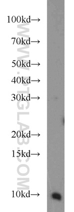 VMA21 Antibody in Western Blot (WB)