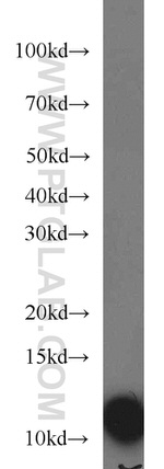 VMA21 Antibody in Western Blot (WB)