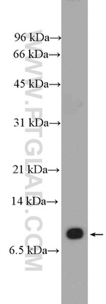 VMA21 Antibody in Western Blot (WB)