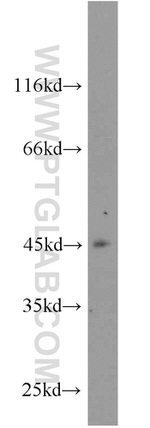 ZNF763 Antibody in Western Blot (WB)