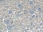 ACC1 Antibody in Immunohistochemistry (Paraffin) (IHC (P))