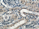 ACC1 Antibody in Immunohistochemistry (Paraffin) (IHC (P))