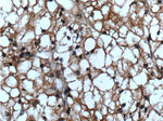 ACC1 Antibody in Immunohistochemistry (Paraffin) (IHC (P))