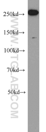 ACC1 Antibody in Western Blot (WB)