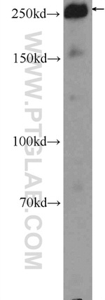 ACC1 Antibody in Western Blot (WB)