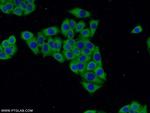 ACC1 Antibody in Immunocytochemistry (ICC/IF)