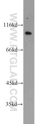 VAV2 Antibody in Western Blot (WB)