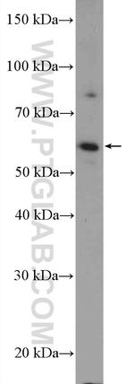 KIAA0895 Antibody in Western Blot (WB)