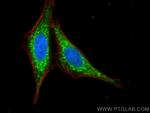 Sclerostin Antibody in Immunocytochemistry (ICC/IF)