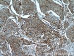 POLD3 Antibody in Immunohistochemistry (Paraffin) (IHC (P))