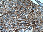 POLD3 Antibody in Immunohistochemistry (Paraffin) (IHC (P))