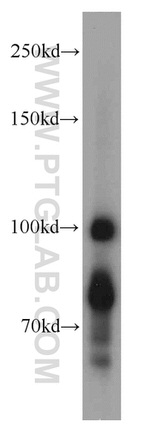 DNAJC6/AUXILIN Antibody in Western Blot (WB)