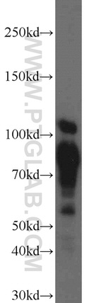 DNAJC6/AUXILIN Antibody in Western Blot (WB)