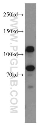 DNAJC6/AUXILIN Antibody in Western Blot (WB)