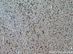 SH3BGRL2 Antibody in Immunohistochemistry (Paraffin) (IHC (P))