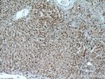 SH3BGRL2 Antibody in Immunohistochemistry (Paraffin) (IHC (P))