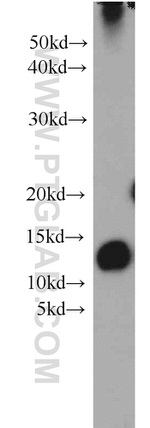 SH3BGRL2 Antibody in Western Blot (WB)