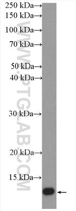 SH3BGRL2 Antibody in Western Blot (WB)