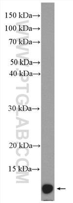 SH3BGRL2 Antibody in Western Blot (WB)