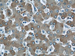 FTCD Antibody in Immunohistochemistry (Paraffin) (IHC (P))