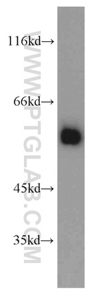 FTCD Antibody in Western Blot (WB)