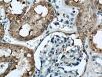 FTCD Antibody in Immunohistochemistry (Paraffin) (IHC (P))