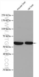 FTCD Antibody in Western Blot (WB)