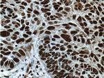 SP1 Antibody in Immunohistochemistry (Paraffin) (IHC (P))