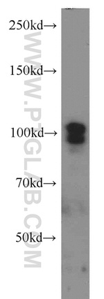 SP1 Antibody in Western Blot (WB)