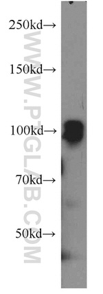 SP1 Antibody in Western Blot (WB)