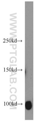 SP1 Antibody in Western Blot (WB)