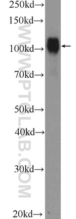 SP1 Antibody in Western Blot (WB)