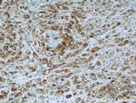 BCL2L12 Antibody in Immunohistochemistry (Paraffin) (IHC (P))