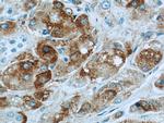 BCL2L12 Antibody in Immunohistochemistry (Paraffin) (IHC (P))