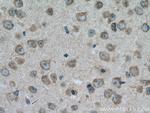 TRPM4 Antibody in Immunohistochemistry (Paraffin) (IHC (P))