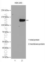 TRPM4 Antibody in Western Blot (WB)