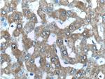 PCCA Antibody in Immunohistochemistry (Paraffin) (IHC (P))