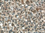 PCCA Antibody in Immunohistochemistry (Paraffin) (IHC (P))