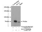 PCCA Antibody in Immunoprecipitation (IP)