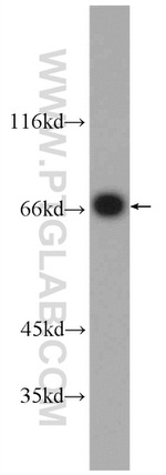 PCCA Antibody in Western Blot (WB)