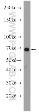 PCCA Antibody in Western Blot (WB)