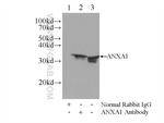 Annexin A1 Antibody in Immunoprecipitation (IP)