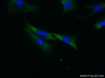 PKC alpha Antibody in Immunocytochemistry (ICC/IF)