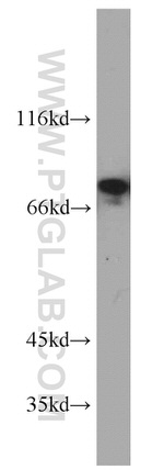 PKC alpha Antibody in Western Blot (WB)