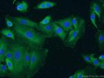 Integrin alpha-3 Antibody in Immunocytochemistry (ICC/IF)