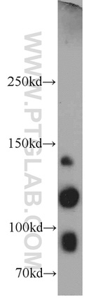 Integrin alpha-3 Antibody in Western Blot (WB)