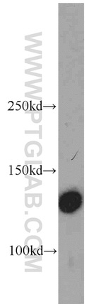 Integrin alpha-3 Antibody in Western Blot (WB)
