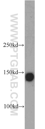 Integrin alpha-3 Antibody in Western Blot (WB)