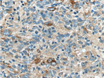 LAMP1 Antibody in Immunohistochemistry (Paraffin) (IHC (P))