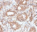 Fibrillin-1 (FBN1) (Marfan Syndrome Marker) Antibody in Immunohistochemistry (Paraffin) (IHC (P))